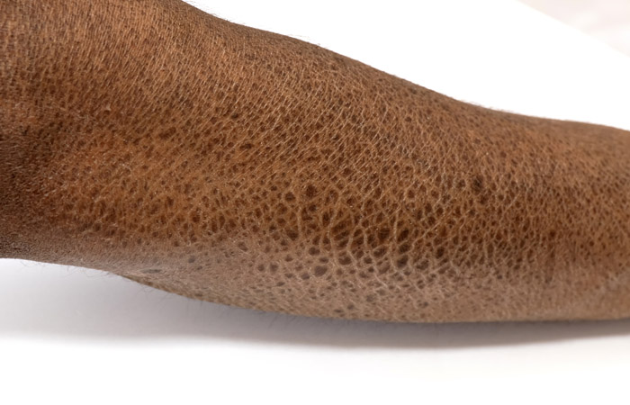 3-ichthyosis-copy